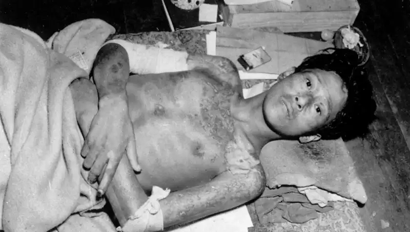 Nagasaki’den Gelen Uyarı: Nükleer Tehdit 80 Yıl Sonra Yeniden Tecrübede!