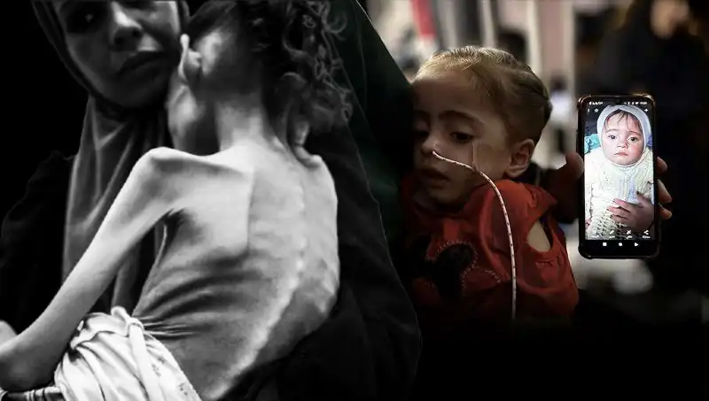 25 Kilodan 10 Kiloya Düşen Meryem'in Açlık Mücadelesi: Yürek Burkan Hikayesi